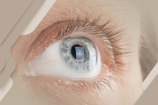 O que leva à queda dos cílios?