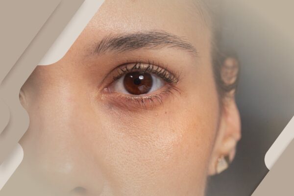 Como a saúde pode interferir no bem-estar da visão