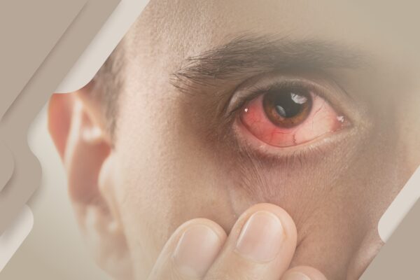 Inflamações e infecções mais comuns aos olhos