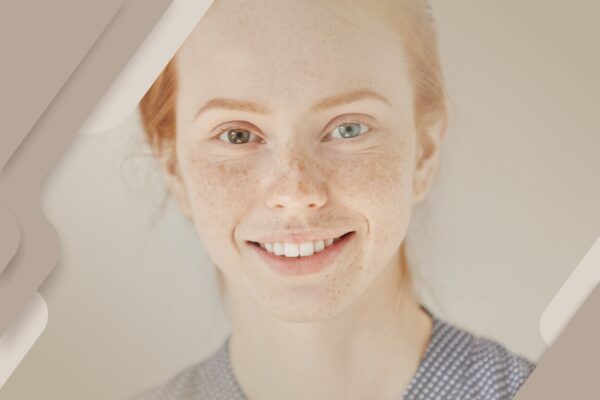 Heterocromia: uma característica fascinante dos olhos