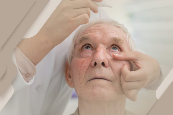 Julho Turquesa e a síndrome do olho seco