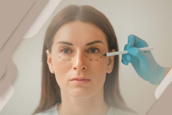 Cuidado! Preenchimento de olheira com ácido hialurônico pode ser muito perigoso