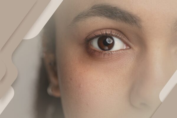 O que a cor dos olhos pode revelar sobre você e sua saúde