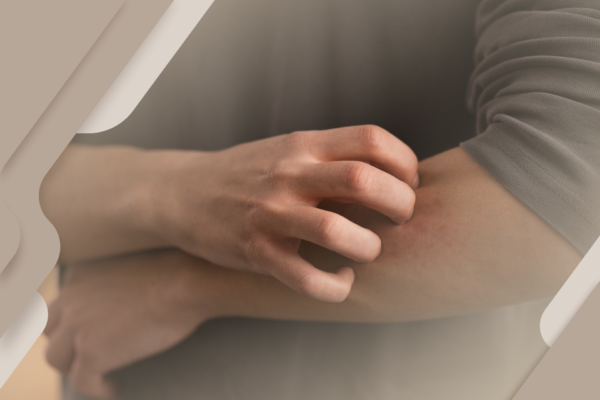 Condições autoimunes podem afetar a sua visão