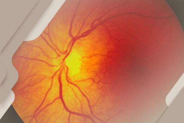 Você sabia que a retina é a tela da nossa visão?